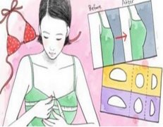 贵阳美贝尔隆胸多少钱