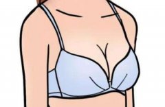 广州美莱医院隆胸多少钱