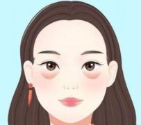 临沂人民医院能做眼袋吗多少钱