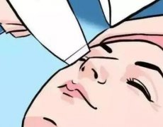 贵阳小拉皮手术费多少钱