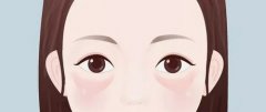 北京协和朱琳做眼袋多少钱