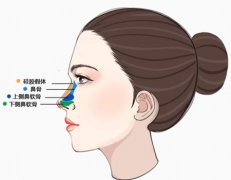 合肥做玻尿酸隆鼻多少钱