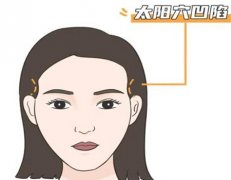 南通玻尿酸丰太阳穴多少钱