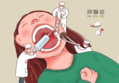 牙齿拔了一直流血咋办？牙齿拔了多久可以镶牙