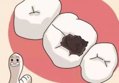 牙齿中间有个洞怎么办