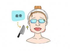 美容整形的全部项目？有唇部整形、鼻子整形、眼部整形、面部轮廓等